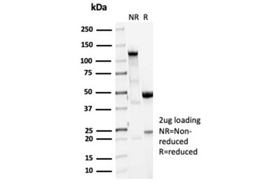 SDS-PAGE - Anti-Vinculin Antibody [VCL/7091R] - BSA and Azide free (A278664) - Antibodies.com