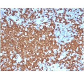 Immunohistochemistry - Anti-ZAP70 Antibody [ZAP70/6492R] - BSA and Azide free (A278666) - Antibodies.com