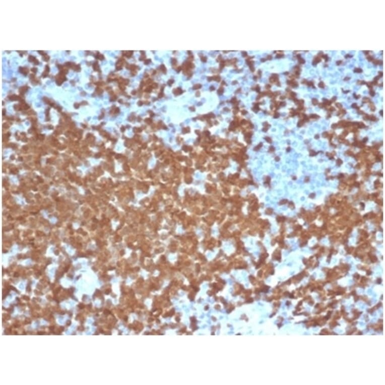 Immunohistochemistry - Anti-ZAP70 Antibody [ZAP70/6492R] - BSA and Azide free (A278666) - Antibodies.com