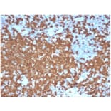 Immunohistochemistry - Anti-ZAP70 Antibody [ZAP70/6492R] - BSA and Azide free (A278666) - Antibodies.com