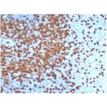 Immunohistochemistry - Anti-ZAP70 Antibody [ZAP70/6492R] - BSA and Azide free (A278666) - Antibodies.com