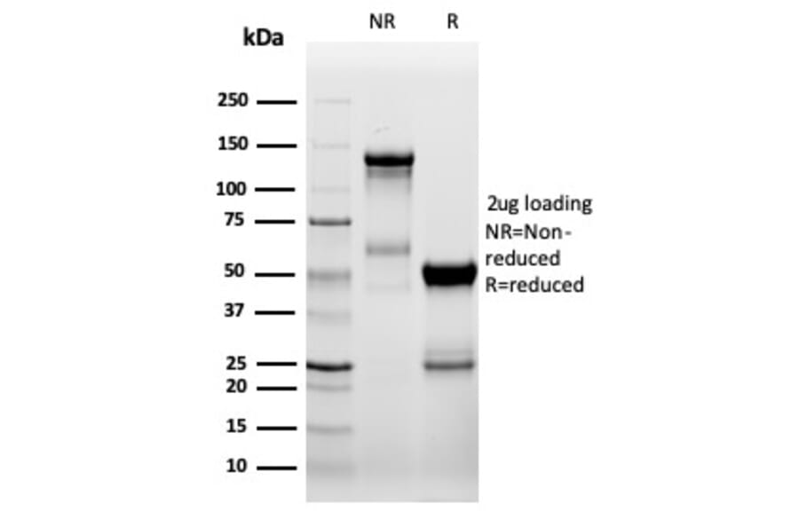 SDS-PAGE - Anti-ZAP70 Antibody [ZAP70/6492R] - BSA and Azide free (A278666) - Antibodies.com