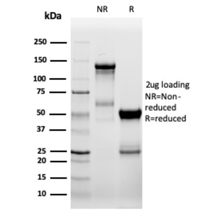 SDS-PAGE - Anti-ZAP70 Antibody [ZAP70/6492R] - BSA and Azide free (A278666) - Antibodies.com