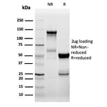 SDS-PAGE - Anti-ZAP70 Antibody [ZAP70/6492R] - BSA and Azide free (A278666) - Antibodies.com