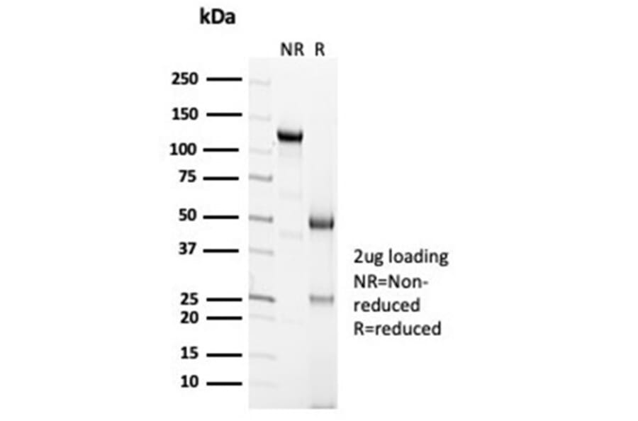 SDS-PAGE - Anti-Calretinin Antibody [CALB2/7029R] - BSA and Azide free (A278667) - Antibodies.com