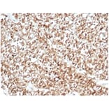 Immunohistochemistry - Anti-Calretinin Antibody [CALB2/7029R] - BSA and Azide free (A278667) - Antibodies.com