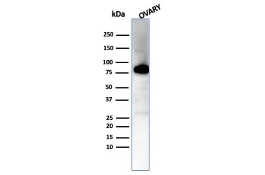 Western Blot - Anti-Caldesmon Antibody [CALD1/7024R] - BSA and Azide free (A278668) - Antibodies.com