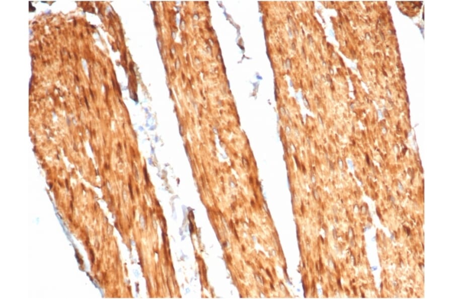 Immunohistochemistry - Anti-Caldesmon Antibody [CALD1/7024R] - BSA and Azide free (A278668) - Antibodies.com