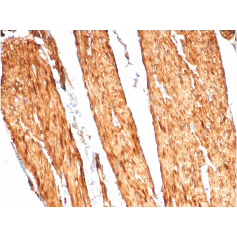 Immunohistochemistry - Anti-Caldesmon Antibody [CALD1/7024R] - BSA and Azide free (A278668) - Antibodies.com