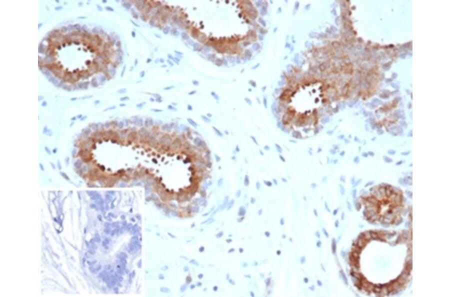 Immunohistochemistry - Anti-BAP1 Antibody [BAP1/6861R] - BSA and Azide free (A278669) - Antibodies.com