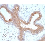 Immunohistochemistry - Anti-BAP1 Antibody [BAP1/6861R] - BSA and Azide free (A278669) - Antibodies.com