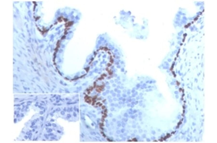 Immunohistochemistry - Anti-p63 Antibody [TP63/4379R] - BSA and Azide free (A278670) - Antibodies.com