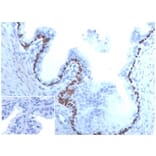 Immunohistochemistry - Anti-p63 Antibody [TP63/4379R] - BSA and Azide free (A278670) - Antibodies.com