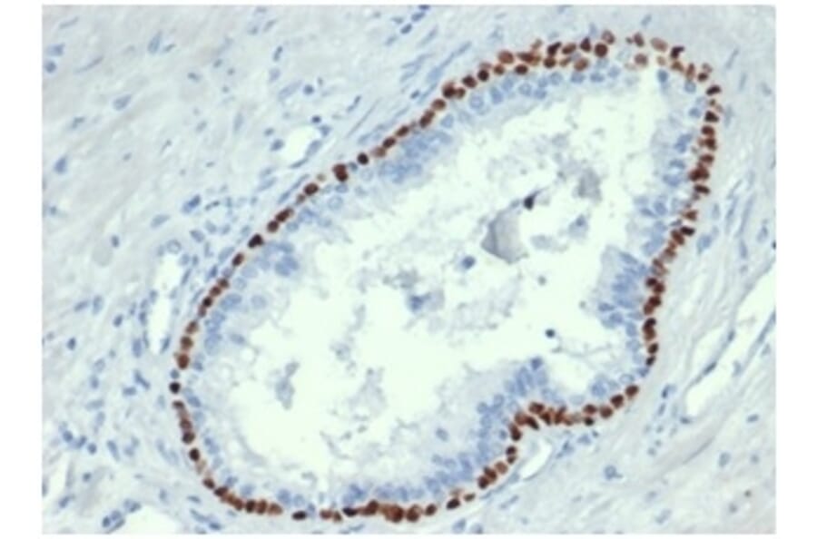Immunohistochemistry - Anti-p63 Antibody [TP63/4379R] - BSA and Azide free (A278670) - Antibodies.com