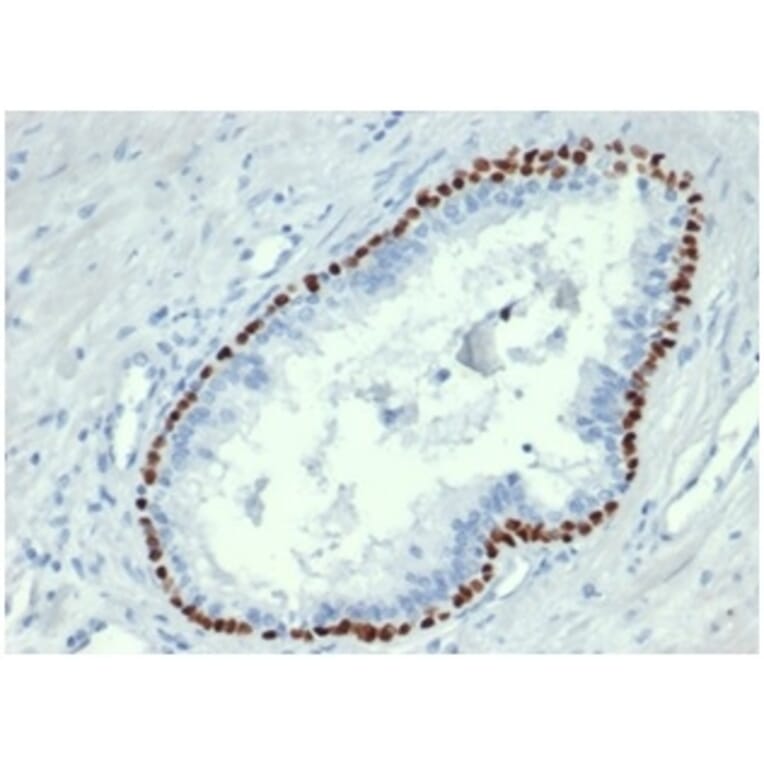 Immunohistochemistry - Anti-p63 Antibody [TP63/4379R] - BSA and Azide free (A278670) - Antibodies.com