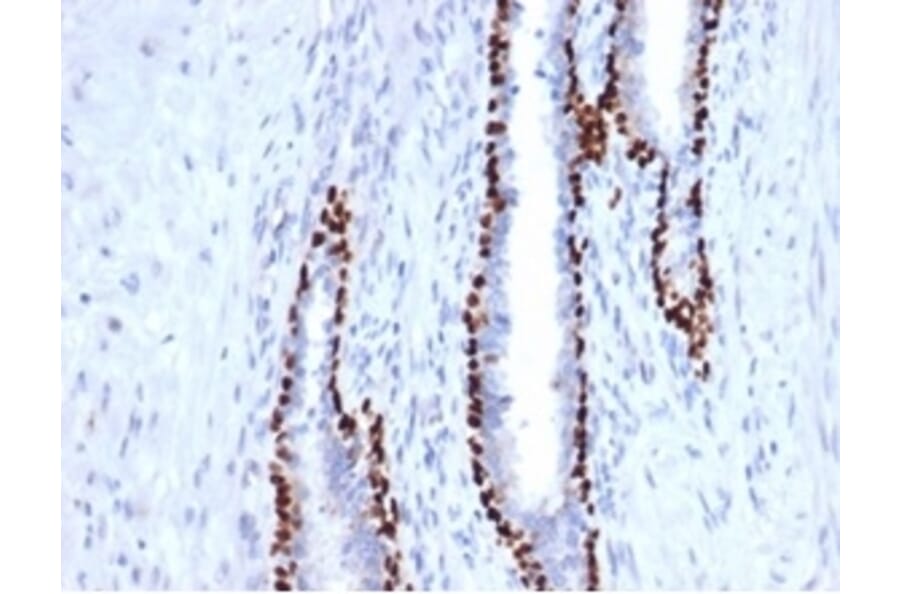 Immunohistochemistry - Anti-p40 Antibody [P40/4396R] - BSA and Azide free (A278671) - Antibodies.com