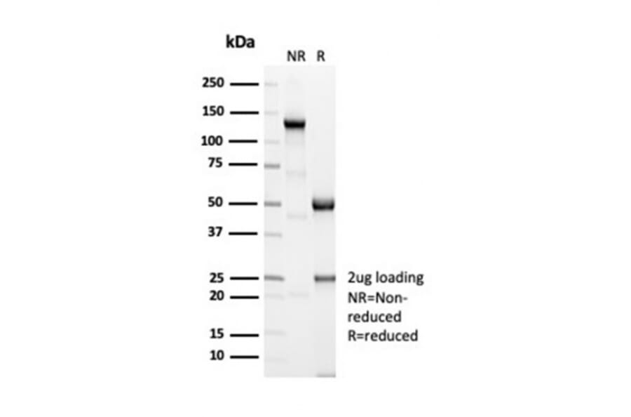 SDS-PAGE - Anti-Sarcomeric Actinin alpha 2 Antibody [ACTN2/7039R] - BSA and Azide free (A278672) - Antibodies.com