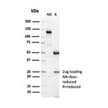 SDS-PAGE - Anti-Sarcomeric Actinin alpha 2 Antibody [ACTN2/7039R] - BSA and Azide free (A278672) - Antibodies.com