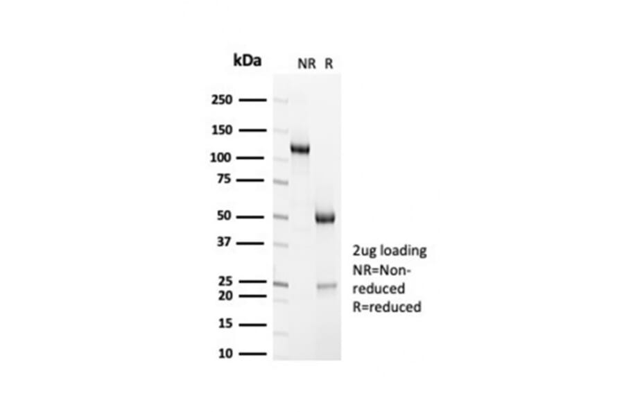 SDS-PAGE - Anti-Sarcomeric Actinin alpha 2 Antibody [ACTN2/7040R] - BSA and Azide free (A278673) - Antibodies.com