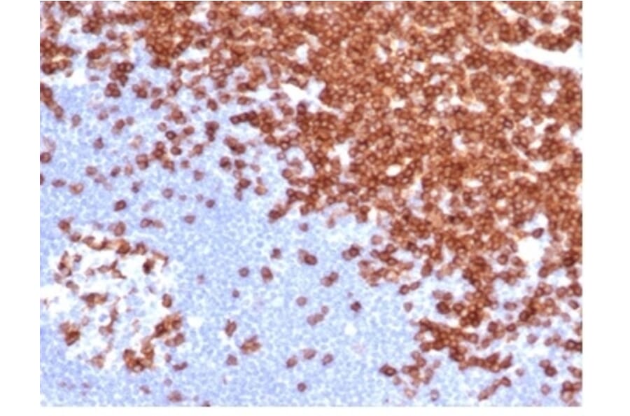 Immunohistochemistry - Anti-CD3 epsilon Antibody [C3e/4652R] - BSA and Azide free (A278675) - Antibodies.com