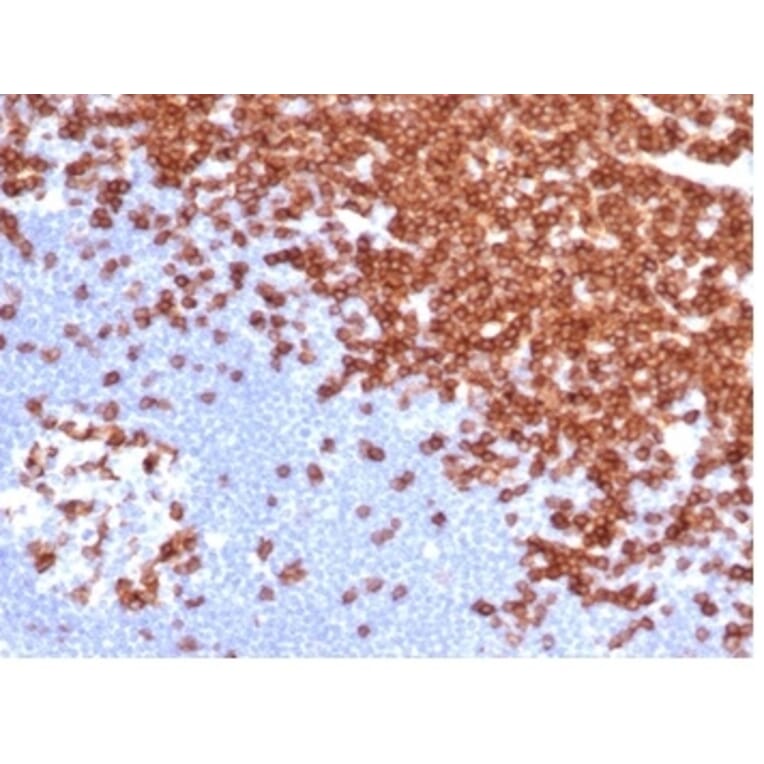 Immunohistochemistry - Anti-CD3 epsilon Antibody [C3e/4652R] - BSA and Azide free (A278675) - Antibodies.com