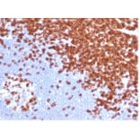 Immunohistochemistry - Anti-CD3 epsilon Antibody [C3e/4652R] - BSA and Azide free (A278675) - Antibodies.com