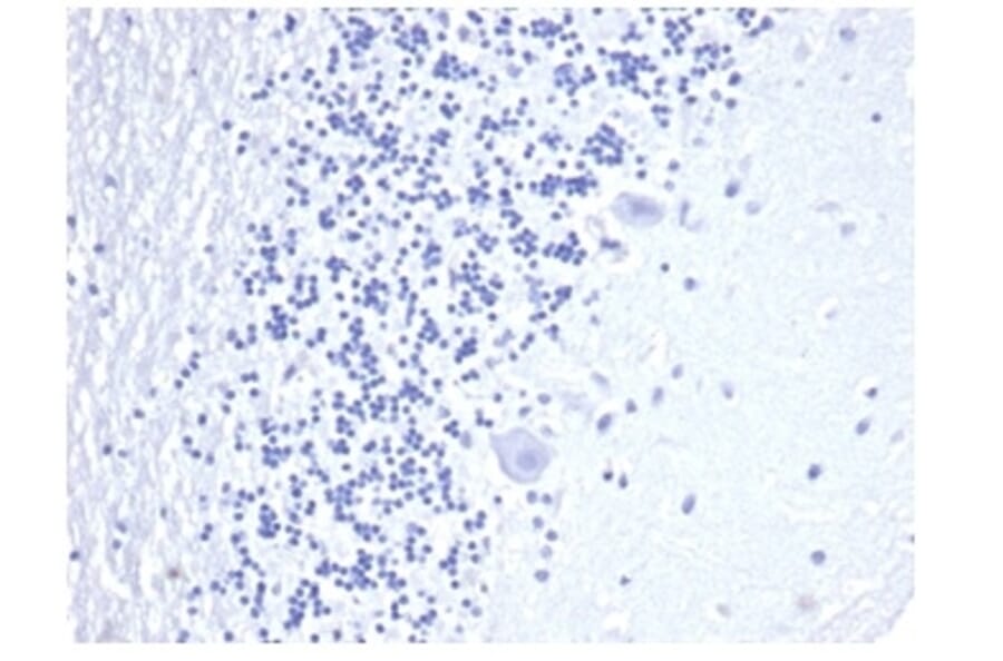 Immunohistochemistry - Anti-CD3 epsilon Antibody [C3e/4652R] - BSA and Azide free (A278675) - Antibodies.com