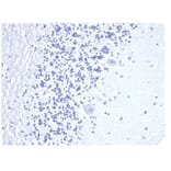 Immunohistochemistry - Anti-CD3 epsilon Antibody [C3e/4652R] - BSA and Azide free (A278675) - Antibodies.com