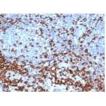 Immunohistochemistry - Anti-CD3 epsilon Antibody [C3e/4652R] - BSA and Azide free (A278675) - Antibodies.com