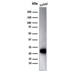 Western Blot - Anti-CD3 epsilon Antibody [C3e/4652R] - BSA and Azide free (A278675) - Antibodies.com