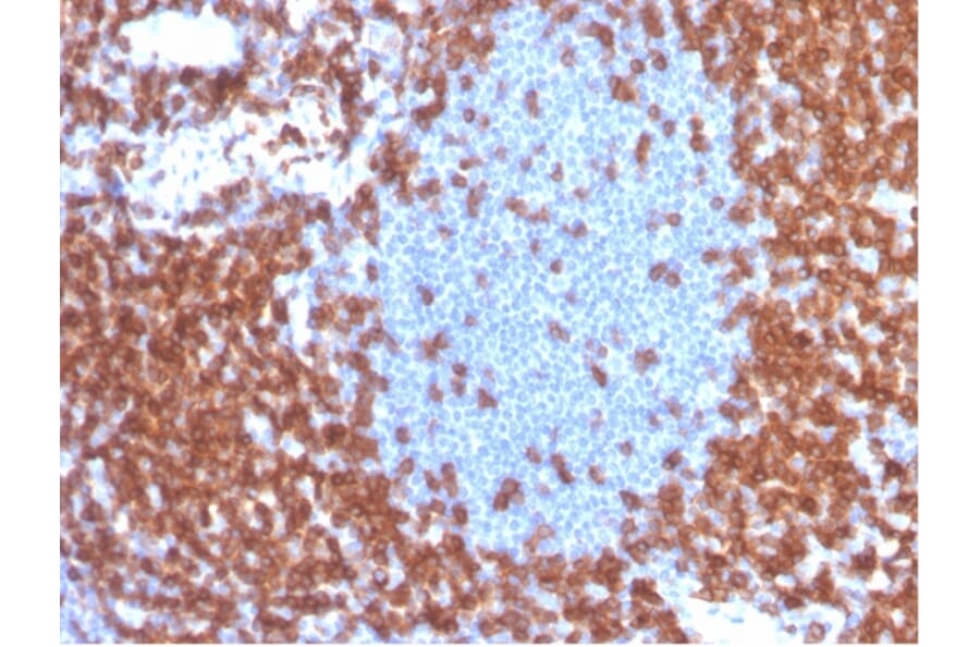 Immunohistochemistry - Anti-CD3 epsilon Antibody [C3e/4653R] - BSA and Azide free (A278676) - Antibodies.com