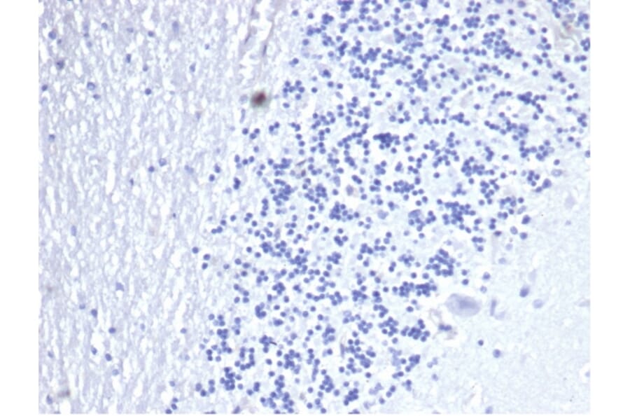 Immunohistochemistry - Anti-CD3 epsilon Antibody [C3e/4653R] - BSA and Azide free (A278676) - Antibodies.com
