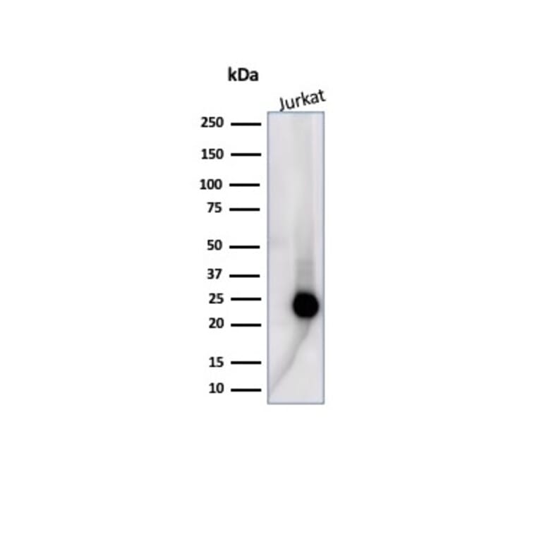 Western Blot - Anti-CD3 epsilon Antibody [C3e/4653R] - BSA and Azide free (A278676) - Antibodies.com