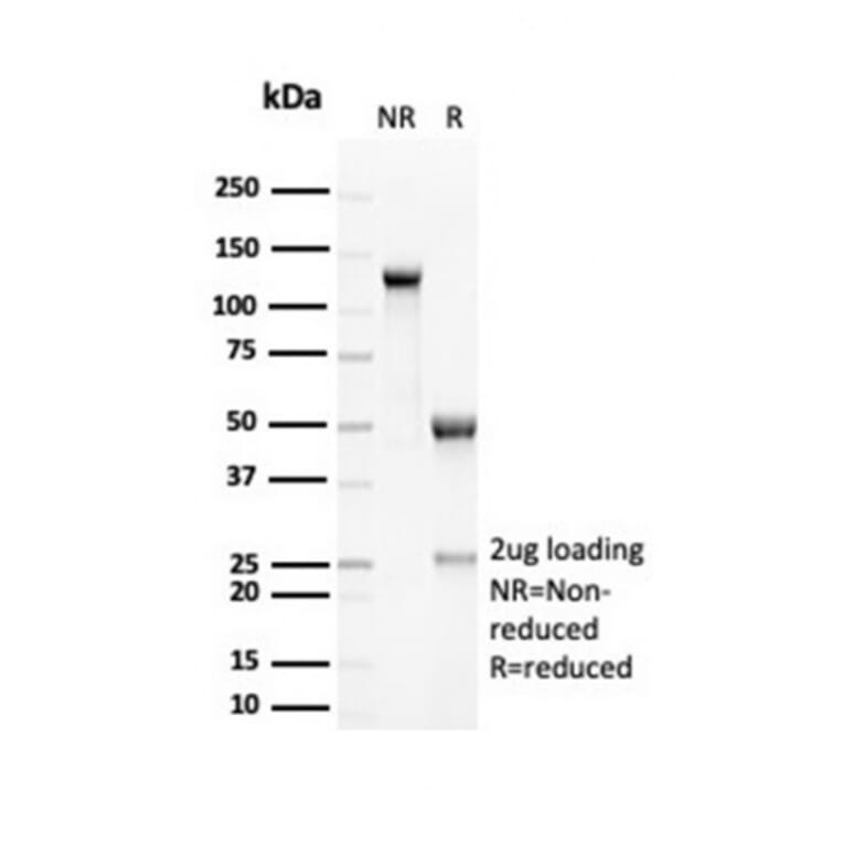 SDS-PAGE - Anti-RCAS1 Antibody [EBAG9/7033R] - BSA and Azide free (A278677) - Antibodies.com