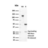SDS-PAGE - Anti-RCAS1 Antibody [EBAG9/7033R] - BSA and Azide free (A278677) - Antibodies.com