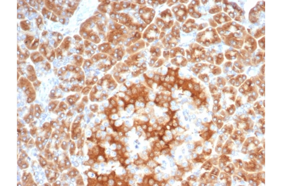 Immunohistochemistry - Anti-RCAS1 Antibody [EBAG9/7033R] - BSA and Azide free (A278677) - Antibodies.com