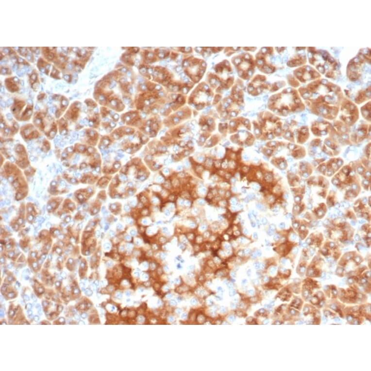 Immunohistochemistry - Anti-RCAS1 Antibody [EBAG9/7033R] - BSA and Azide free (A278677) - Antibodies.com