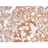 Immunohistochemistry - Anti-RCAS1 Antibody [EBAG9/7033R] - BSA and Azide free (A278677) - Antibodies.com