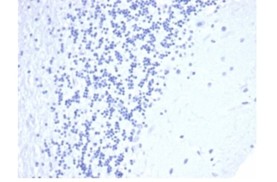 Immunohistochemistry - Anti-CD5 Antibody [C5/4561R] - BSA and Azide free (A278678) - Antibodies.com