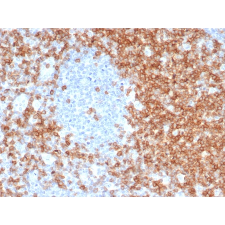 Immunohistochemistry - Anti-CD5 Antibody [C5/6463R] - BSA and Azide free (A278679) - Antibodies.com