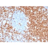 Immunohistochemistry - Anti-CD5 Antibody [C5/6463R] - BSA and Azide free (A278679) - Antibodies.com