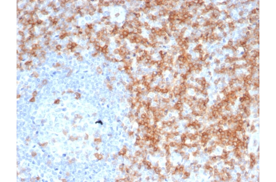 Immunohistochemistry - Anti-CD5 Antibody [C5/6463R] - BSA and Azide free (A278679) - Antibodies.com