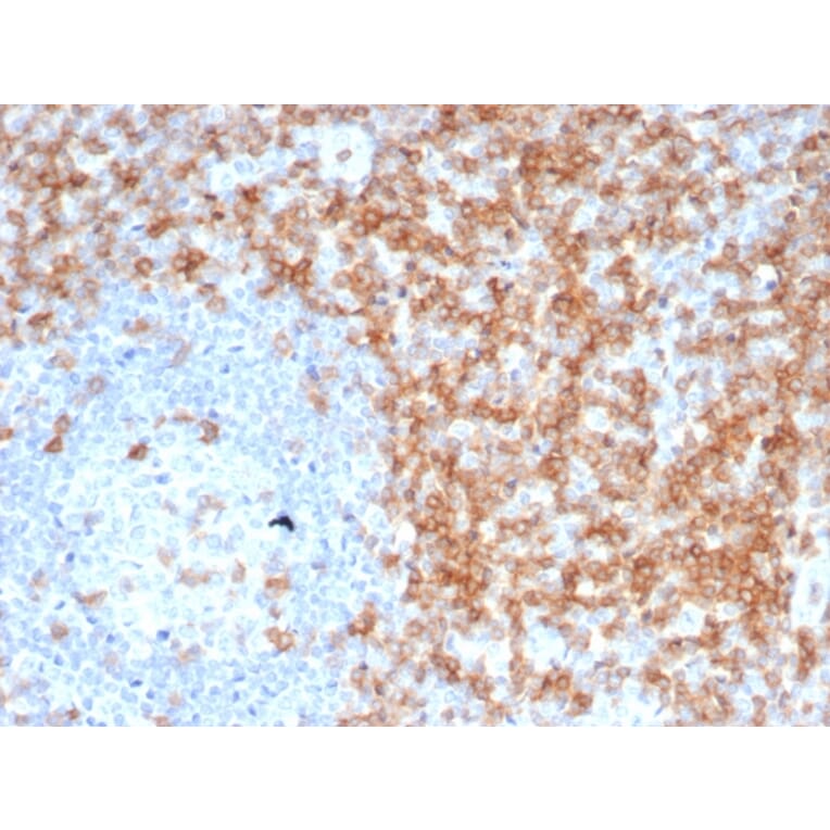 Immunohistochemistry - Anti-CD5 Antibody [C5/6463R] - BSA and Azide free (A278679) - Antibodies.com