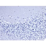 Immunohistochemistry - Anti-CD5 Antibody [C5/6463R] - BSA and Azide free (A278679) - Antibodies.com
