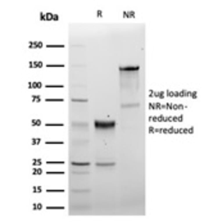 SDS-PAGE - Anti-CD5 Antibody [C5/6463R] - BSA and Azide free (A278679) - Antibodies.com