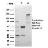 SDS-PAGE - Anti-CD5 Antibody [C5/6463R] - BSA and Azide free (A278679) - Antibodies.com
