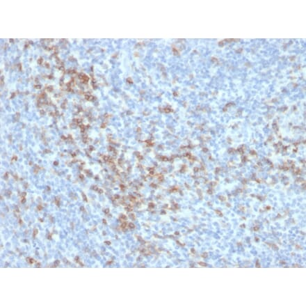 Immunohistochemistry - Anti-CD5 Antibody [C5/6438R] - BSA and Azide free (A278680) - Antibodies.com