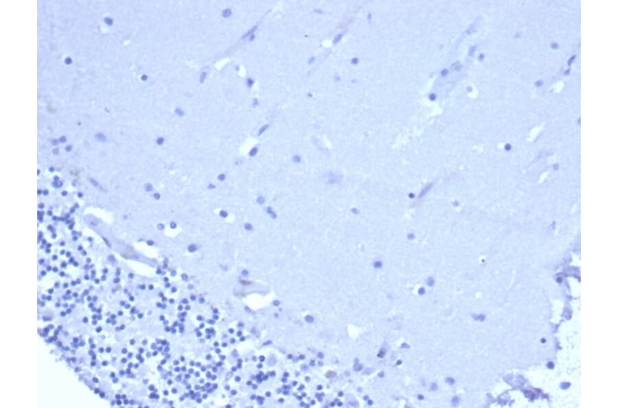Immunohistochemistry - Anti-CD5 Antibody [C5/6438R] - BSA and Azide free (A278680) - Antibodies.com