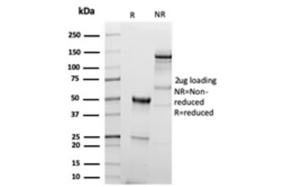 SDS-PAGE - Anti-CD5 Antibody [C5/6438R] - BSA and Azide free (A278680) - Antibodies.com