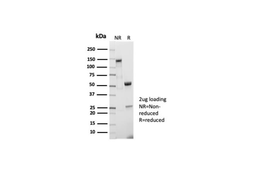 SDS-PAGE - Anti-CD5 Antibody [C5/7020R] - BSA and Azide free (A278681) - Antibodies.com